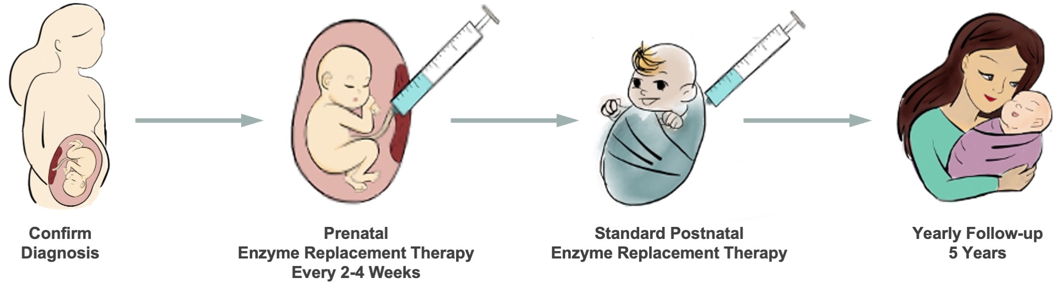 Drawing describing the four steps in the clinical trial, pregnant person confirms diagnosis, fetus receiving prenatal ERT between 18-35 weeks, postnatal standard ERT to baby, baby and parent to be seen yearly for follow up